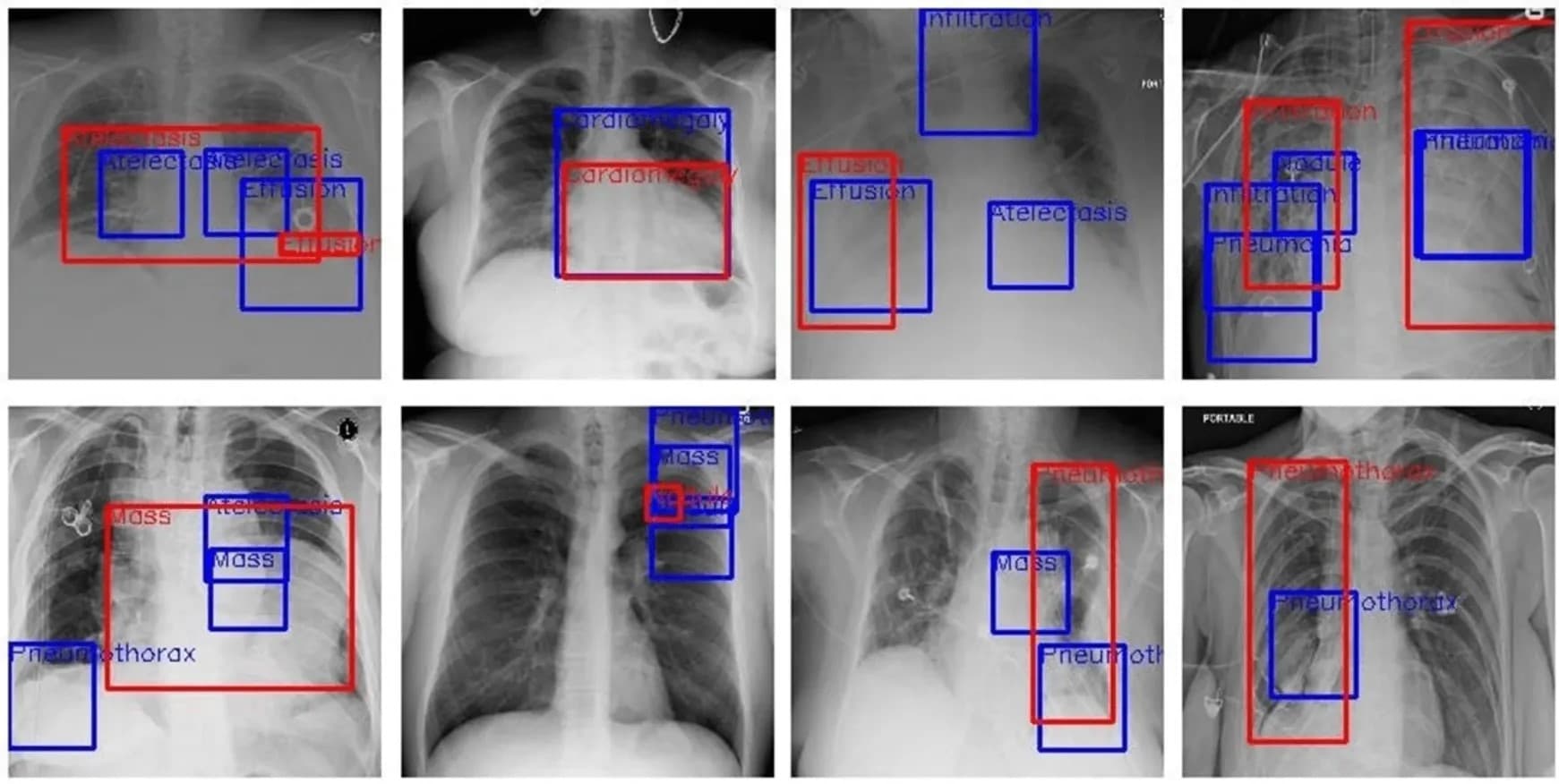 Medical Data Annotation